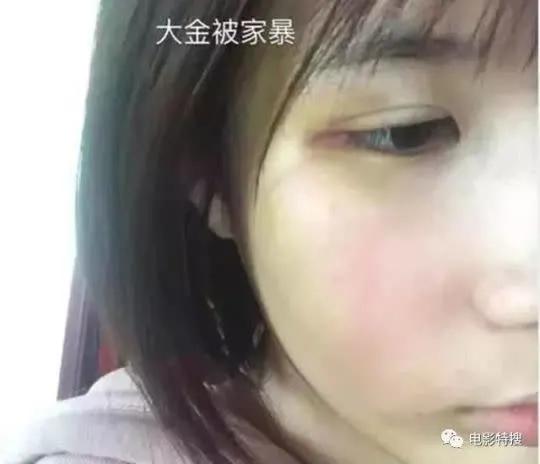 Đại Kim từng tố cáo bạo hành và ngoại tình của Hứa Khải