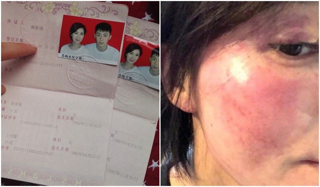 Bằng chứng bạo hành của Hoàng Cảnh Du